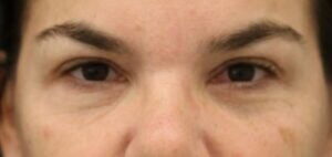 Case # 25 after photo