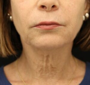 Case # 1 before photo