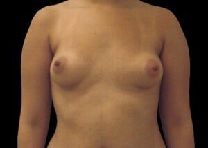 Case # 11 before photo