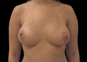 Case # 11 after photo