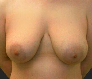 Case # 2 before photo