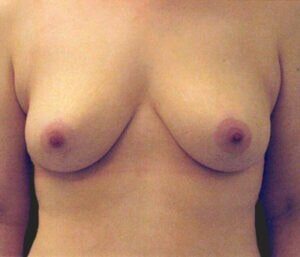 Case # 2 after photo