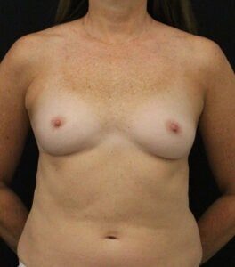 Case # 12 before photo