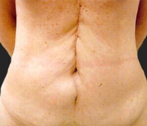 Case # 7 before photo