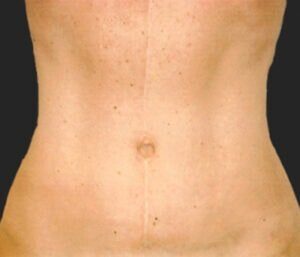 Case # 7 after photo