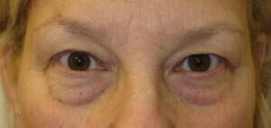 Case # 9 before photo