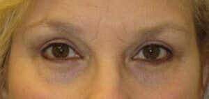 Case # 9 after photo