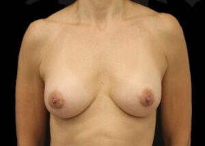 Case # 5 after photo