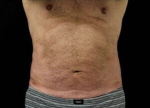 Case # 4 after photo