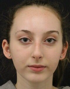 Case # 10 before photo