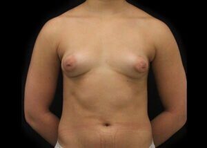 Case # 2 before photo