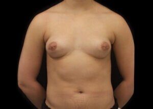 Case # 2 after photo