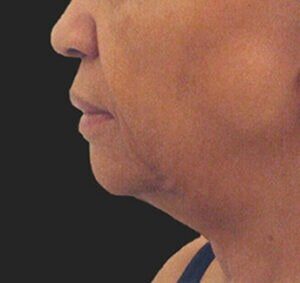 Case # 2 before photo