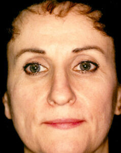 Case # 4 before photo