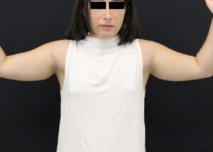 Case # 2 before photo