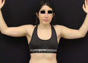 Case # 2 after photo