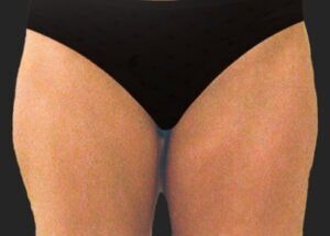 Case # 5 before photo