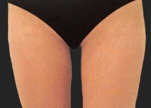 Case # 5 after photo