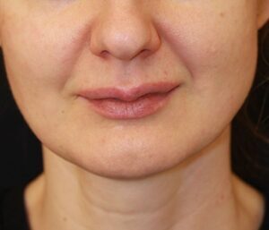 Case # 2 before photo