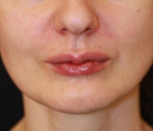 Case # 2 after photo