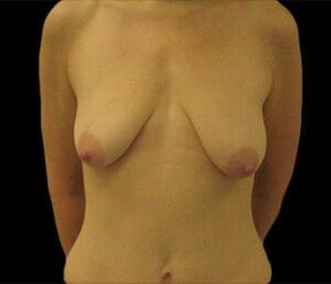 Case # 5 before photo