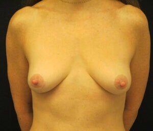 Case # 5 after photo