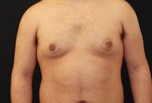 Case # 1 before photo