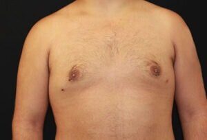 Case # 1 after photo