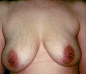 Case # 5 before photo