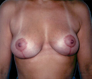 Case # 5 after photo