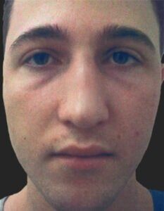 Case # 1 before photo