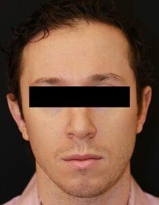 Case # 1 after photo