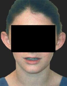 Case # 2 before photo