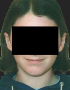 Case # 2 after photo