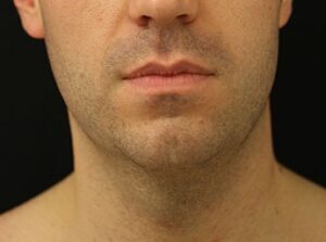 Case # 16 before photo