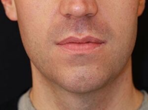 Case # 16 after photo