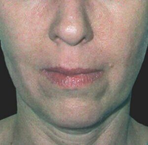 Case # 3 before photo