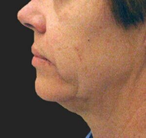 Case # 4 before photo