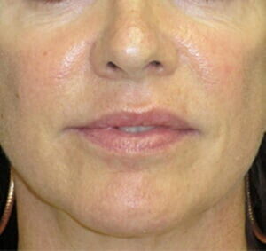 Case # 7 after photo