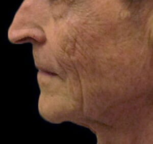 Case # 8 before photo