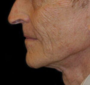 Case # 8 after photo