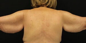 Case # 1 before photo