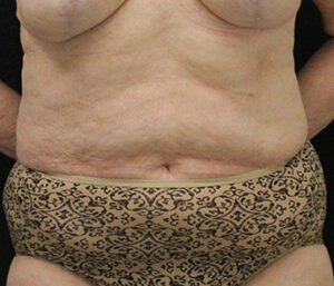 Case # 7 before photo