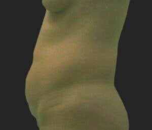 Case # 12 before photo