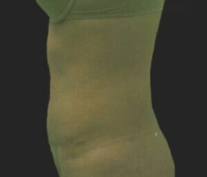 Case # 12 after photo