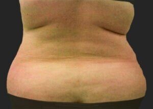 Case # 6 before photo