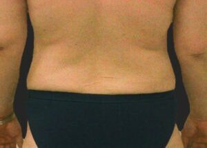 Case # 6 after photo