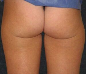 Case # 4 before photo