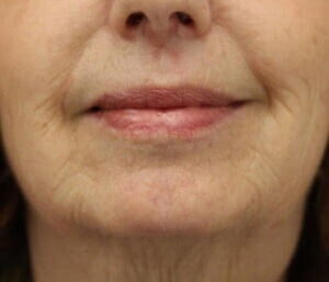 Case # 3 before photo