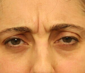 Case # 4 before photo